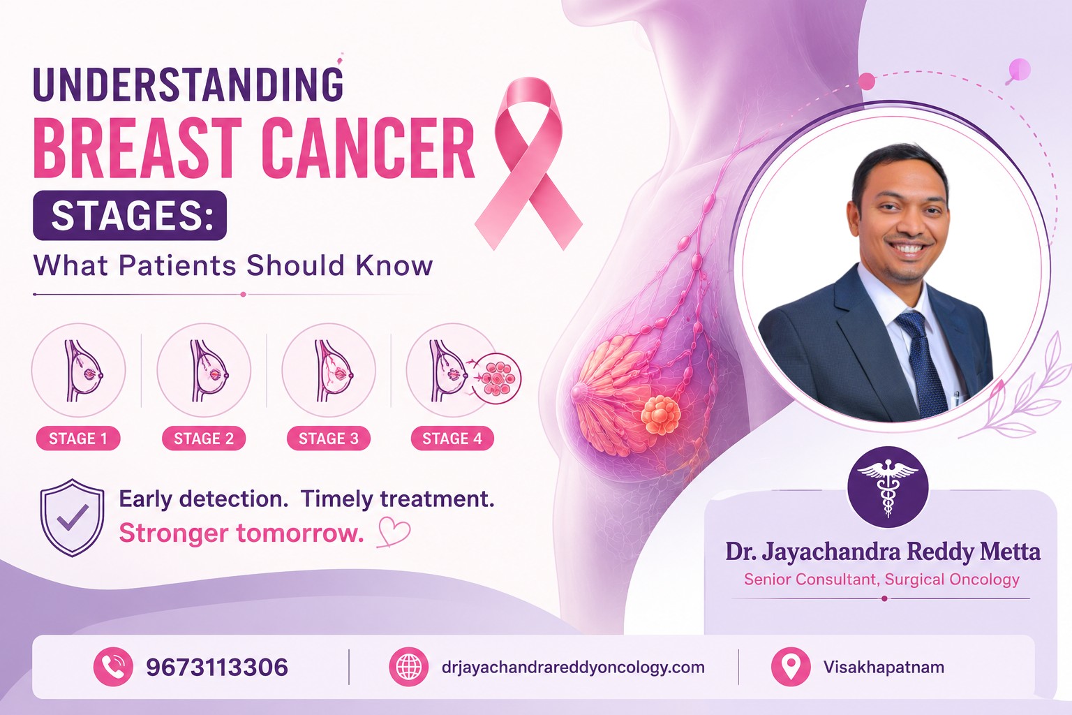 Understanding Breast Cancer Stages: What Patients Should Know